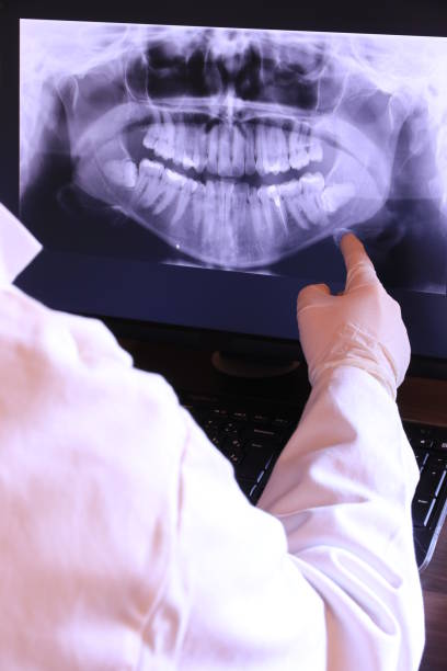 Best Emergency Dental Care for Abscessed Tooth in Drexel, OH